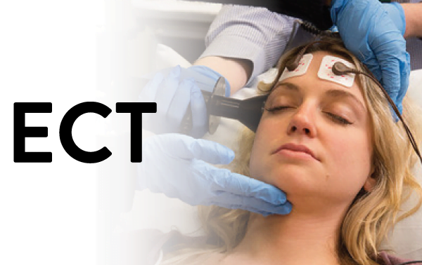 Ect Treatments – What They Are and How to Get Them